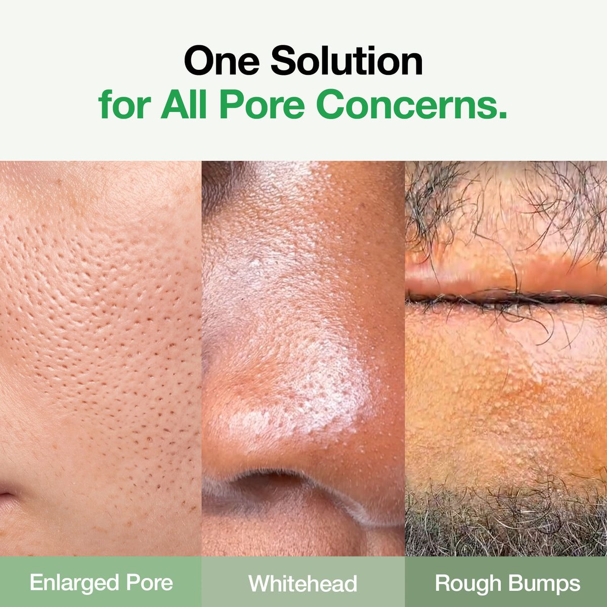 [Cardi B's Choice] Green Tomato Pore Cleanser