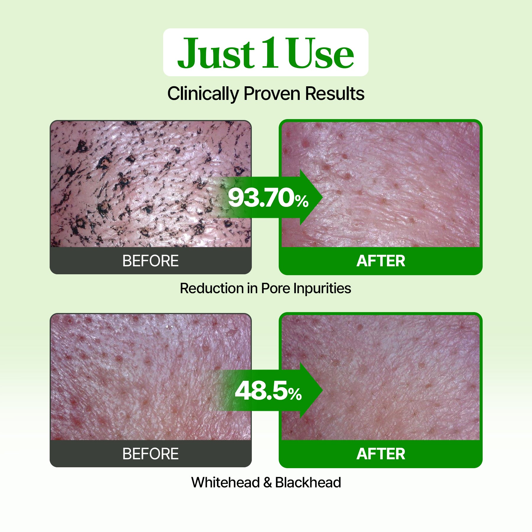 [Amazon] Pore Mask Special Deal