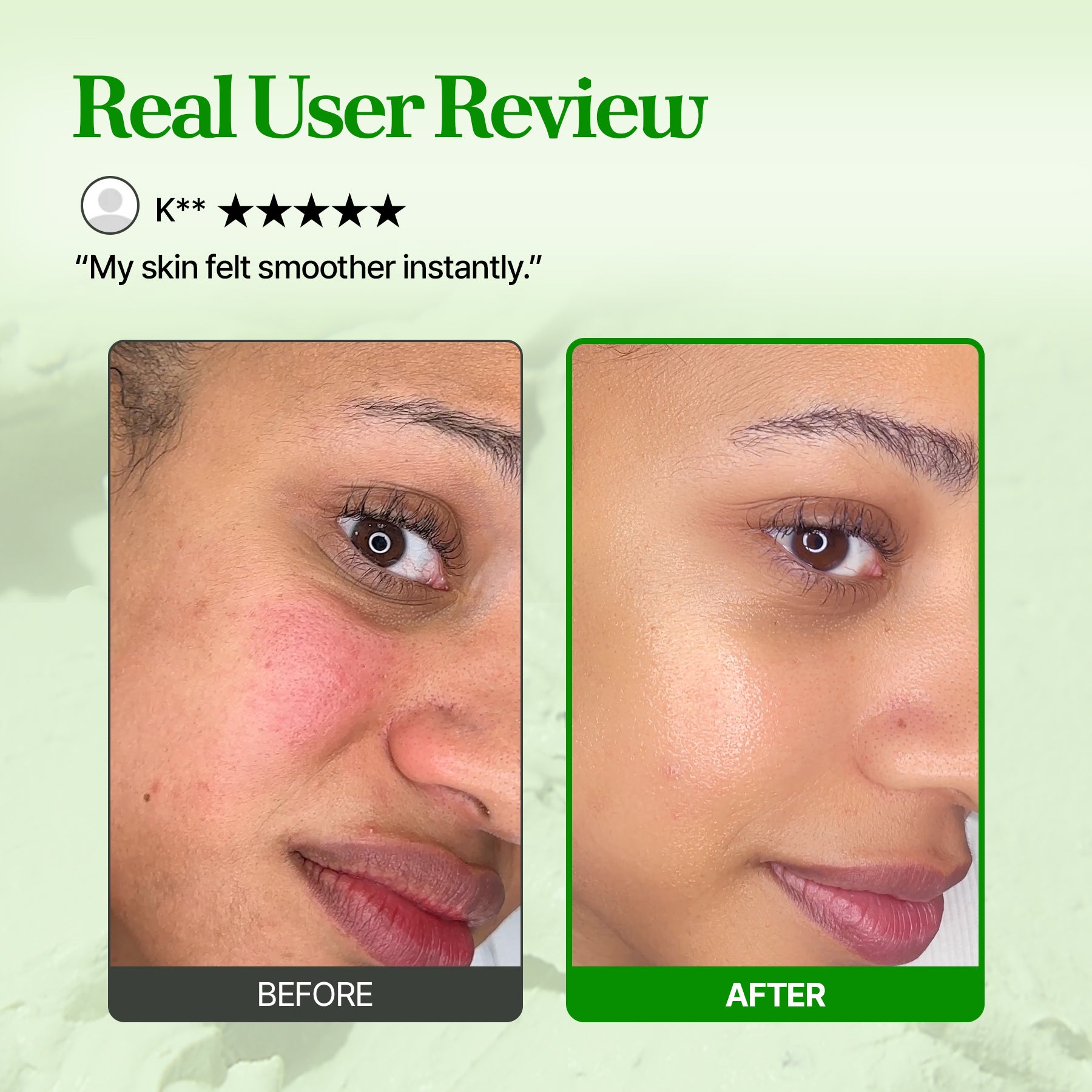 [Amazon] Pore Mask Special Deal