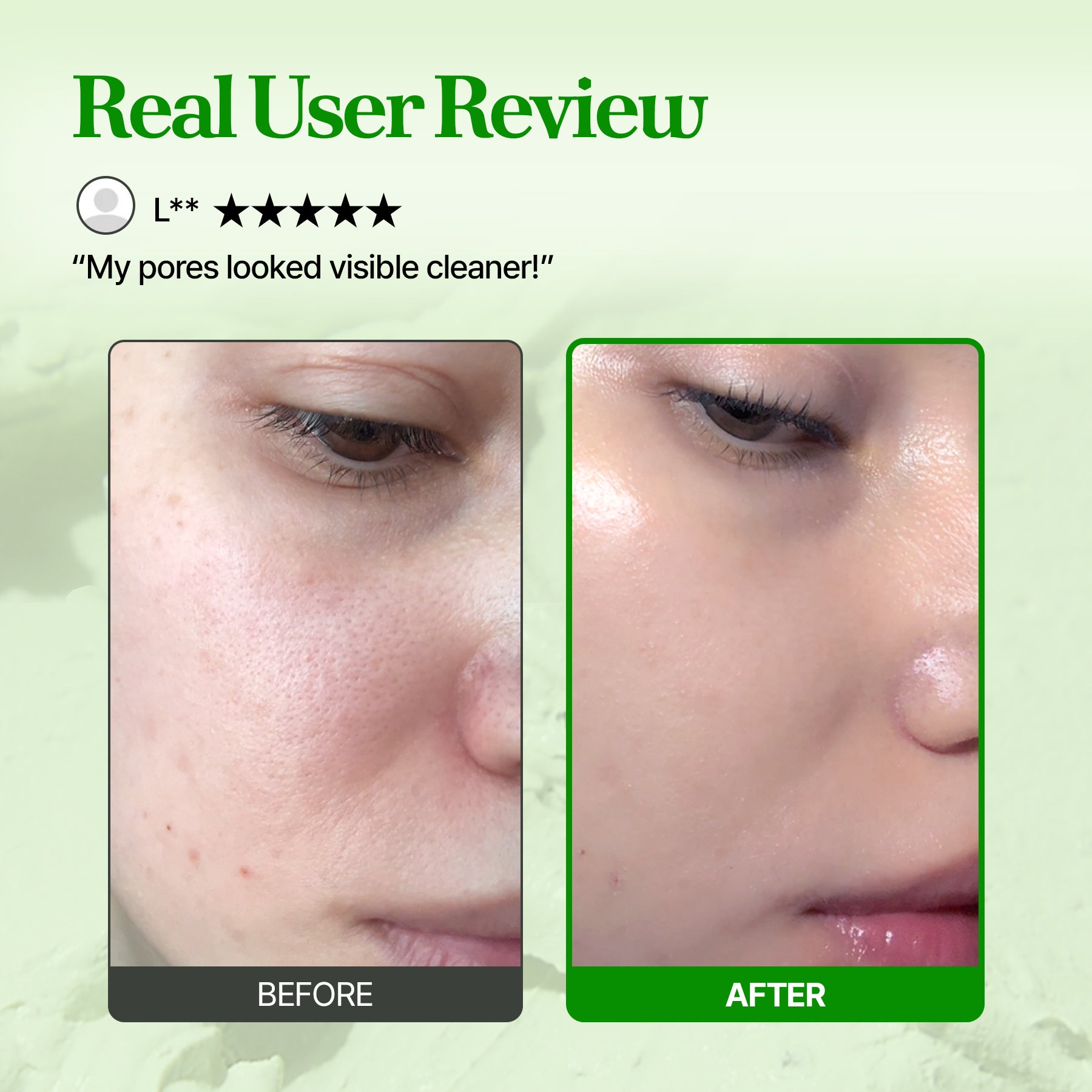 [Amazon] Pore Mask Special Deal