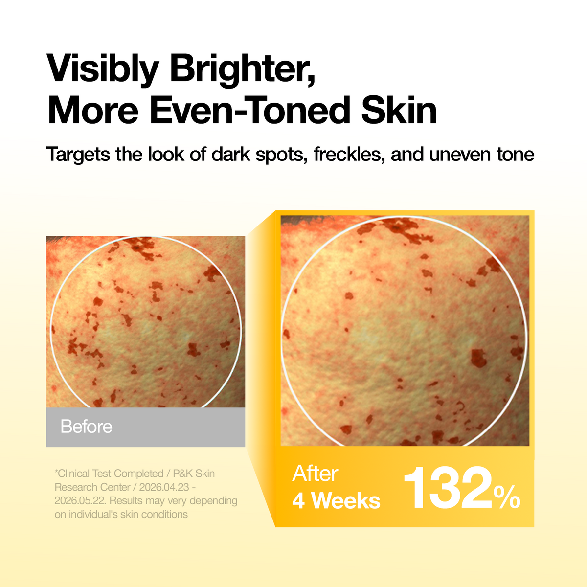 (Amazon) Kojic Acid Niacin C Quick Brightening Mask